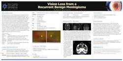 Vision Loss from a Recurrent Benign Meningioma